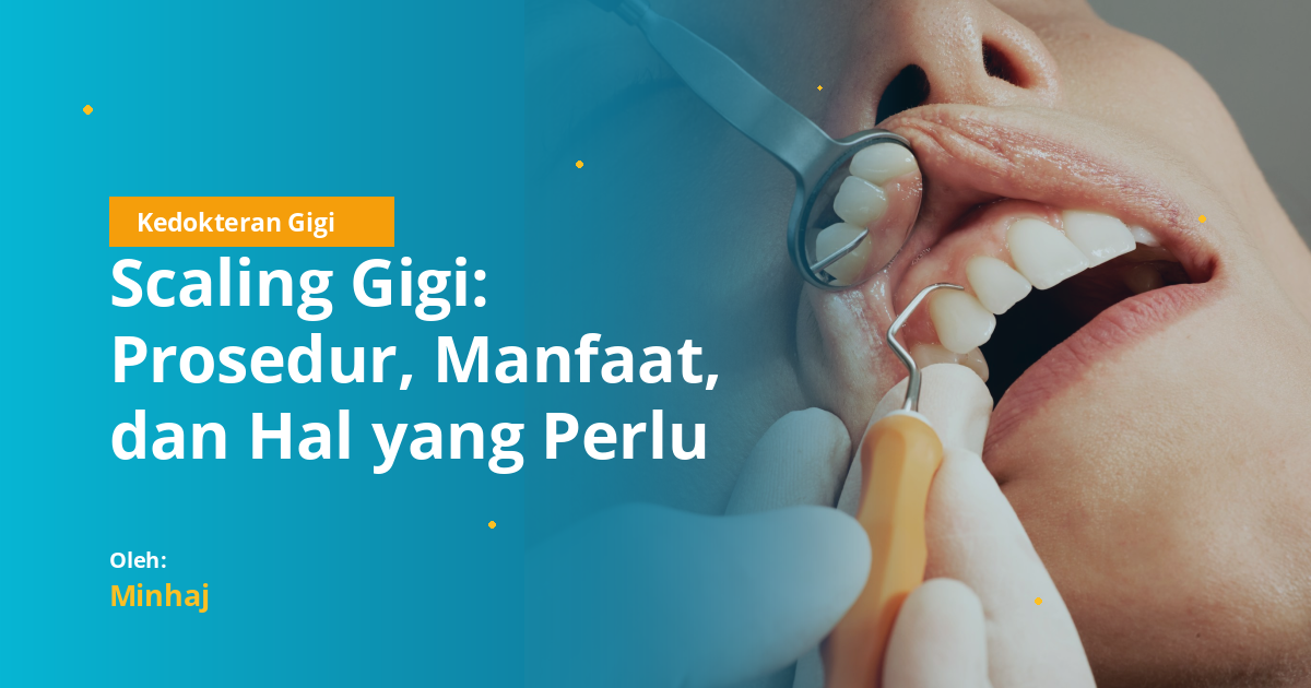 Scaling Gigi: Prosedur, Manfaat, dan Hal yang Perlu Diketahui Mahasiswa Kedokteran Gigi