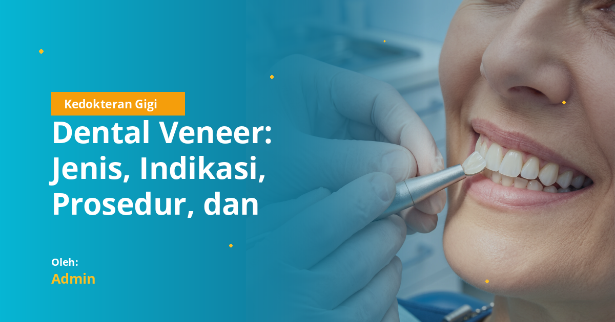 Dental Veneer: Jenis, Indikasi, Prosedur, dan Perawatan Lengkap untuk Mahasiswa Kedokteran Gigi
