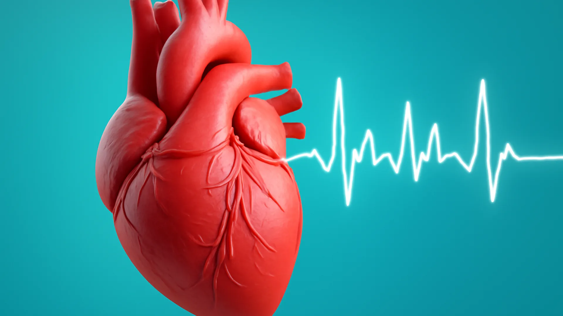 Atrial Fibrilasi