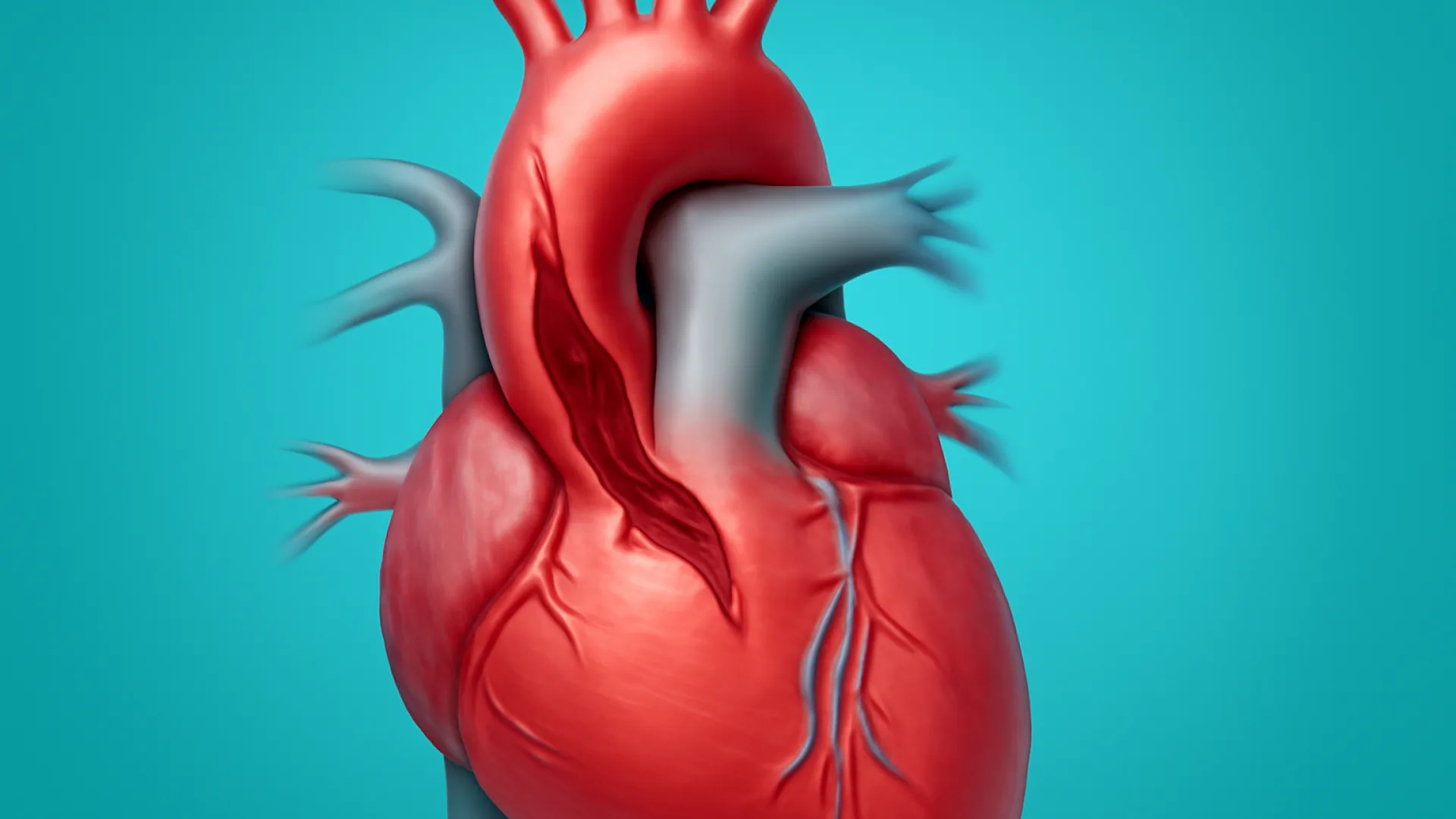Diseksi Aorta