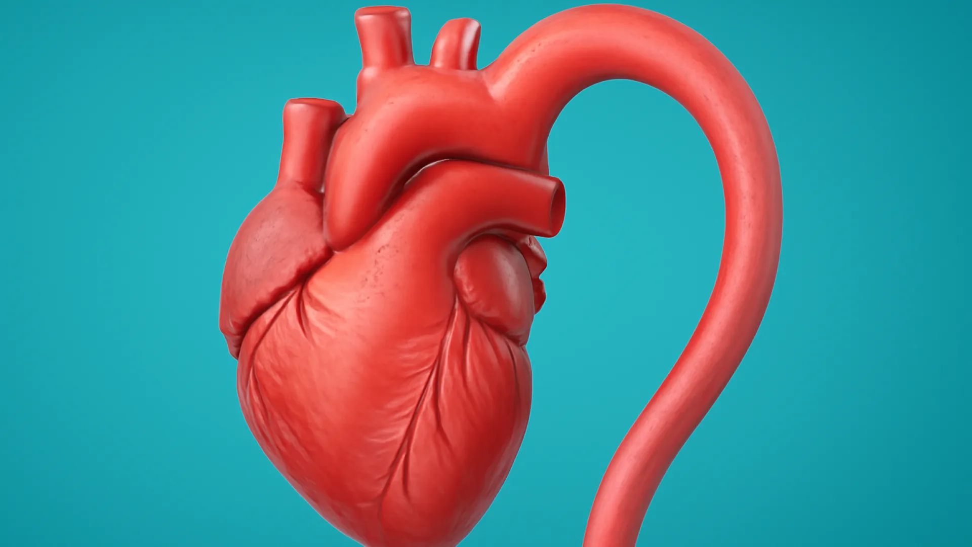Koarktasio Aorta