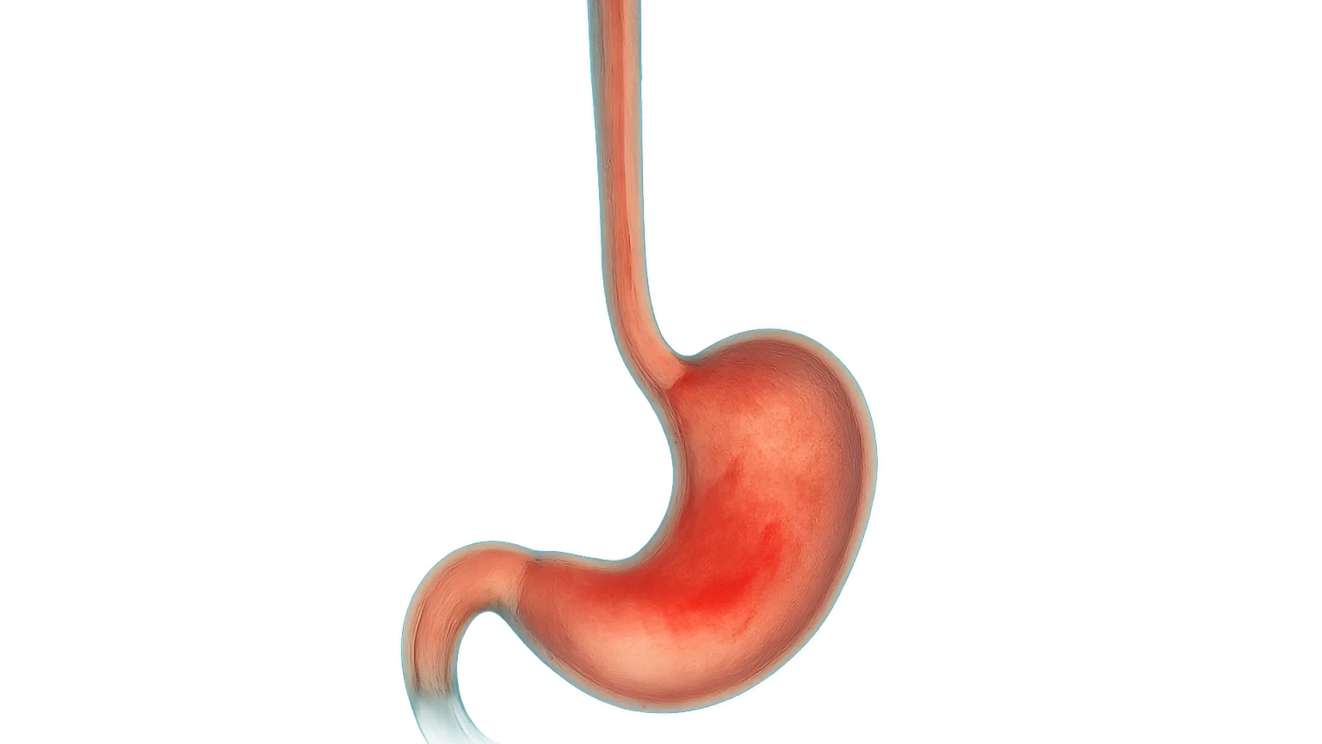Gastritis / GERD / PUD