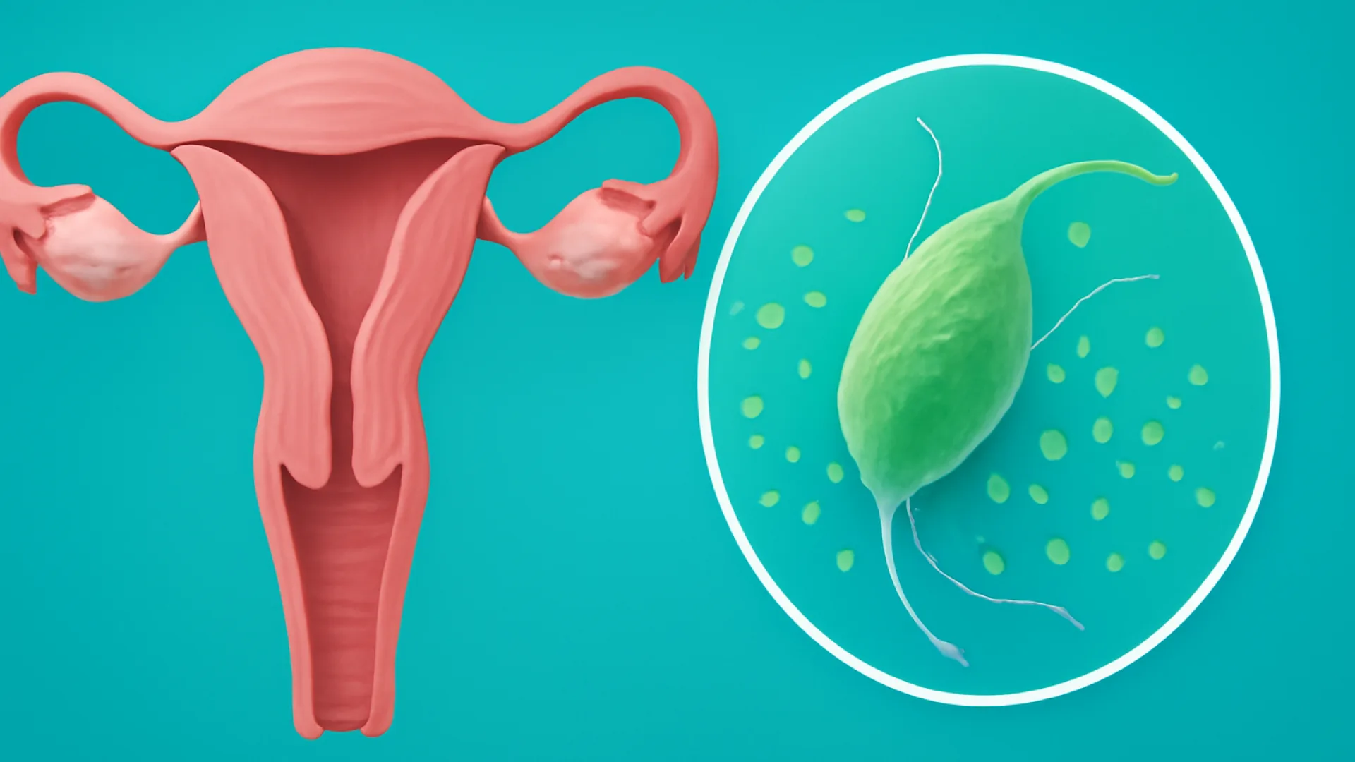 Vaginosis / Trikomonas